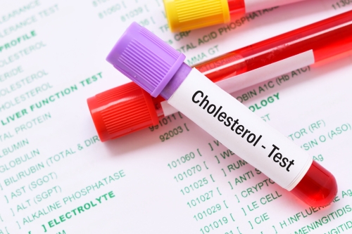 Cholesterol