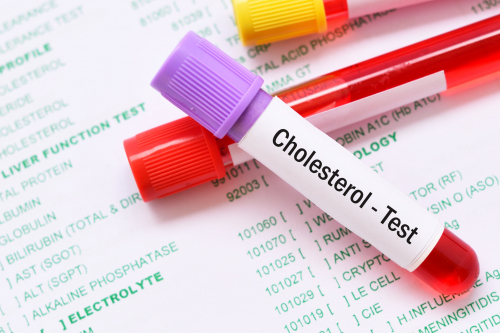 Cholesterol