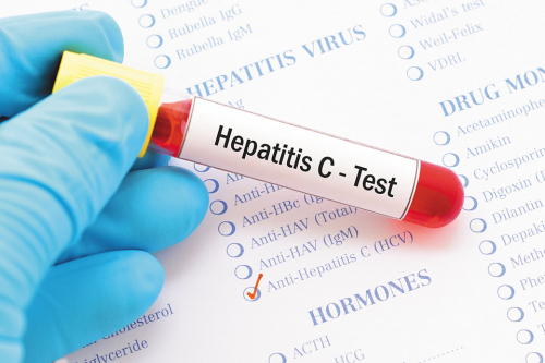 hepatitis