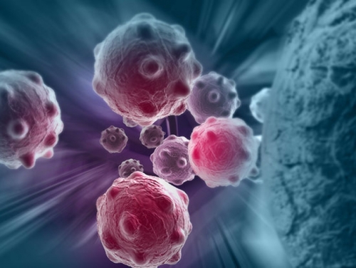 Multiple myeloma (MM)