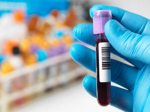 blood sample