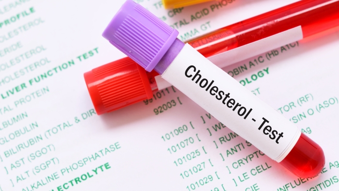 Cholesterol