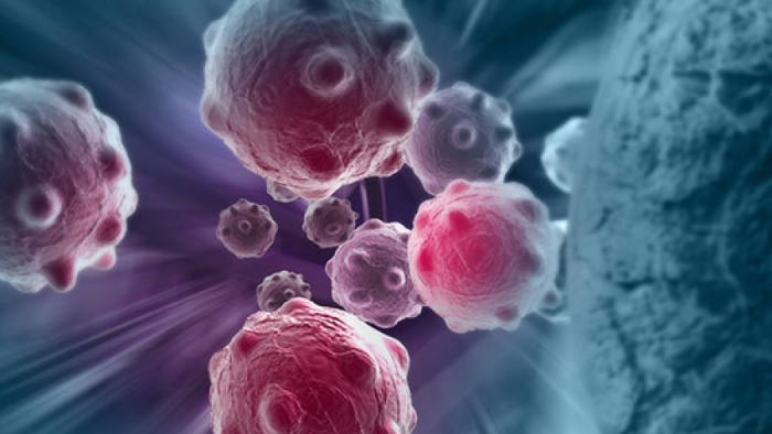 Multiple myeloma (MM)